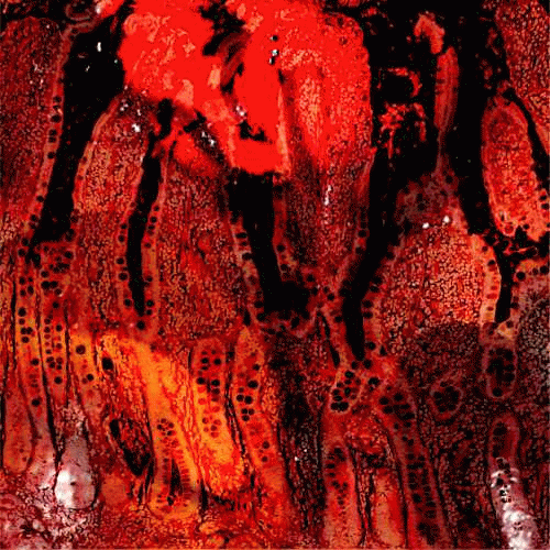 Medicine Noose : Medicine Noose - Spewn